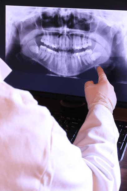 Best Dental Abscess Treatment in Fulton, MS